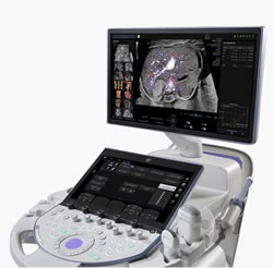 Knights Raised Funds for an Ultrasound Machine